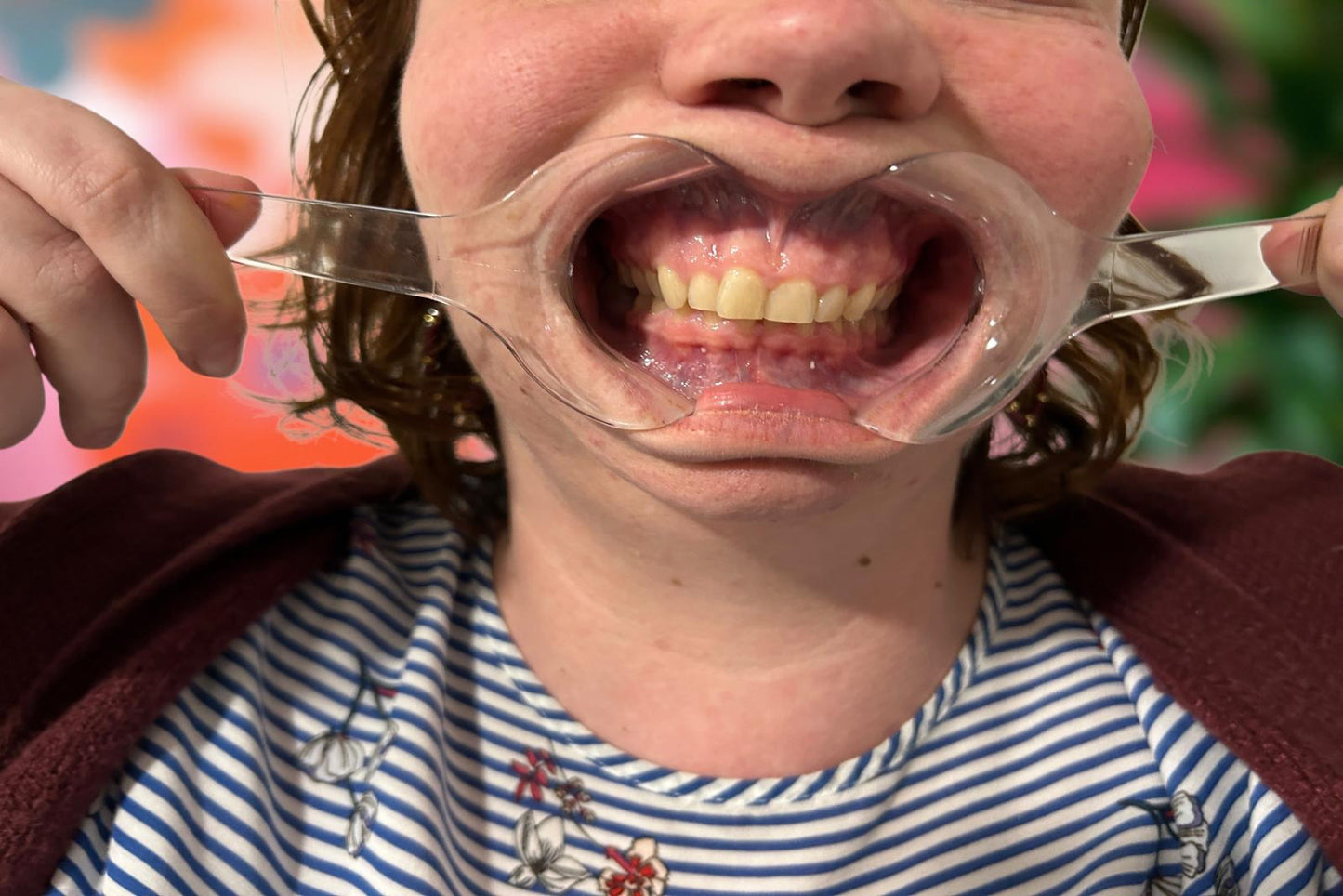 Matériel orthophonie