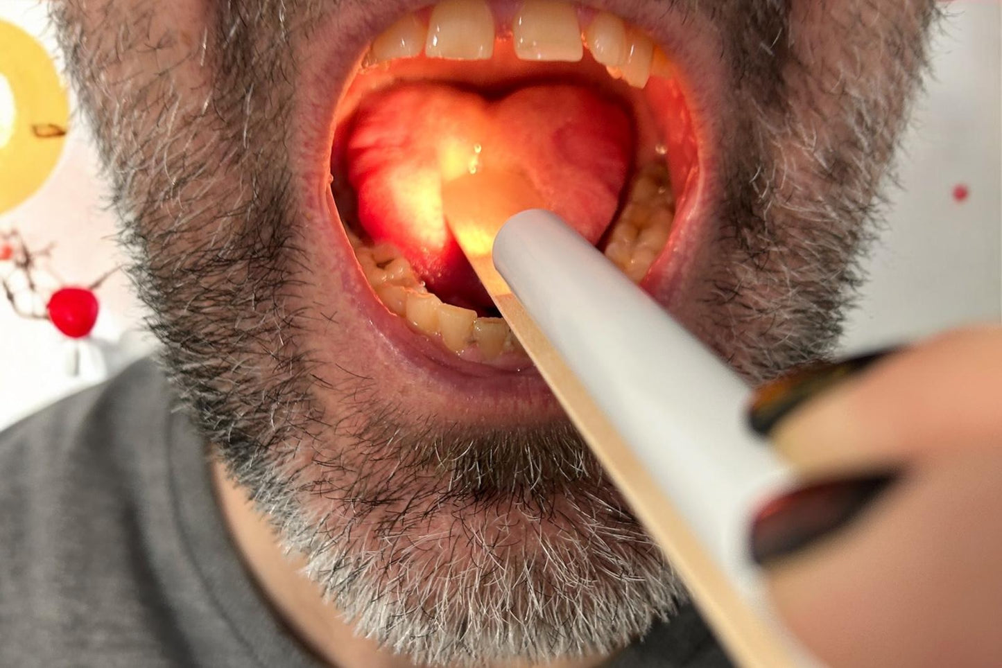 Matériel orthophonie